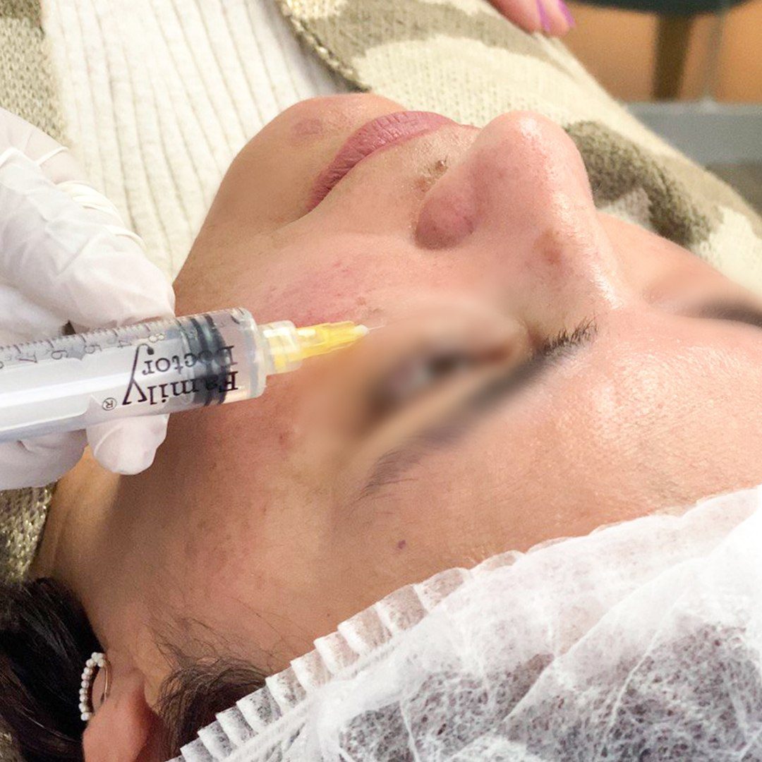 Enzimas Biológicas por zonas
