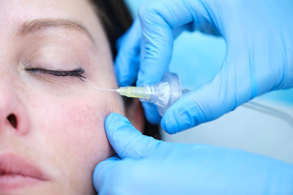 carboxiterapia ojeras