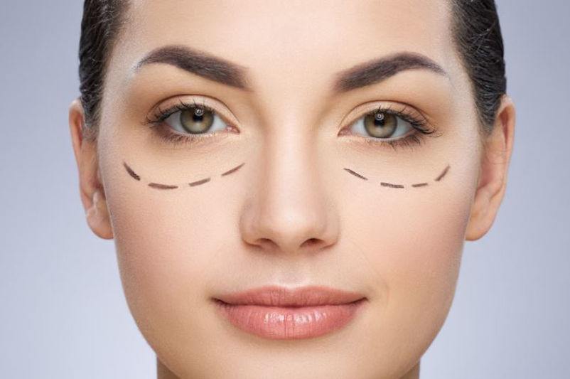 Consejos para Evitar las Ojeras o Bolsas: Hábitos Saludables y Tratamientos Naturales