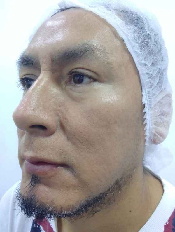 antes consulta dermatologica 1.1